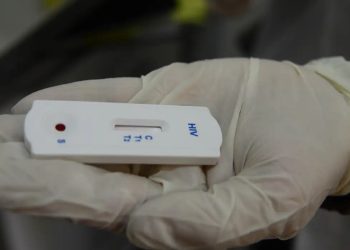 Farmácias autorizadas a realizar testes de ISTs devem ficar atentas à nota técnica do Ministério da Saúde