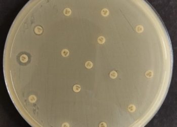 Risco global: bactéria multirresistente é encontrada em paciente brasileira