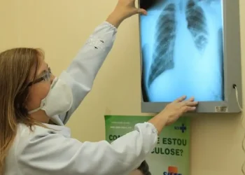 Ministério da Saúde repassa R$ 100 milhões para combate à tuberculose em 913 municípios