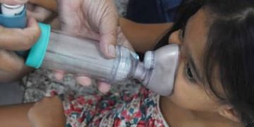 InfoGripe: aumenta casos de síndrome respiratória em crianças menores de 2 anos em todo o país InfoGripe: aumenta casos de síndrome respiratória em crianças menores de 2 anos em todo o país